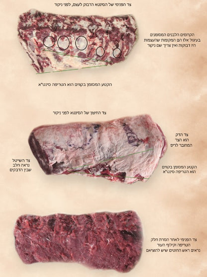 סדר הניקור לבעל העיטור עם פירוש הר"ץ